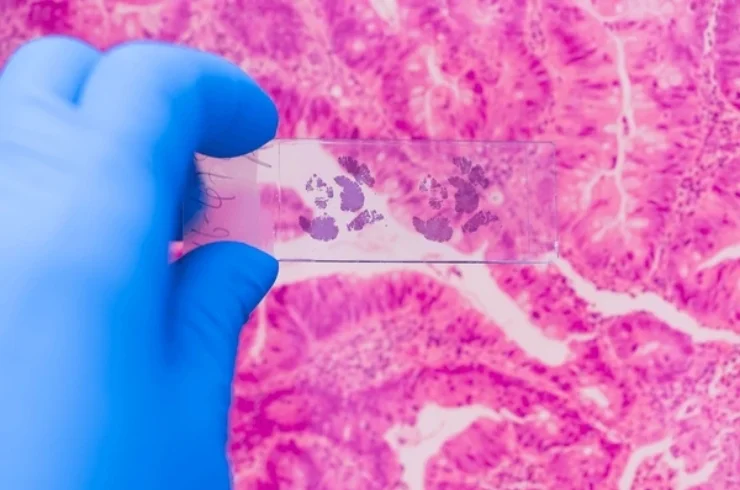 Cytology & Histopathology-------11